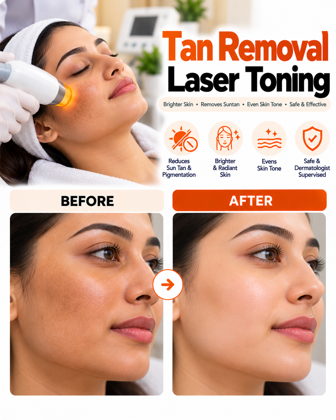 Tan removal laser toning before and after at Vridhi Skin Clinic, Sindhanur