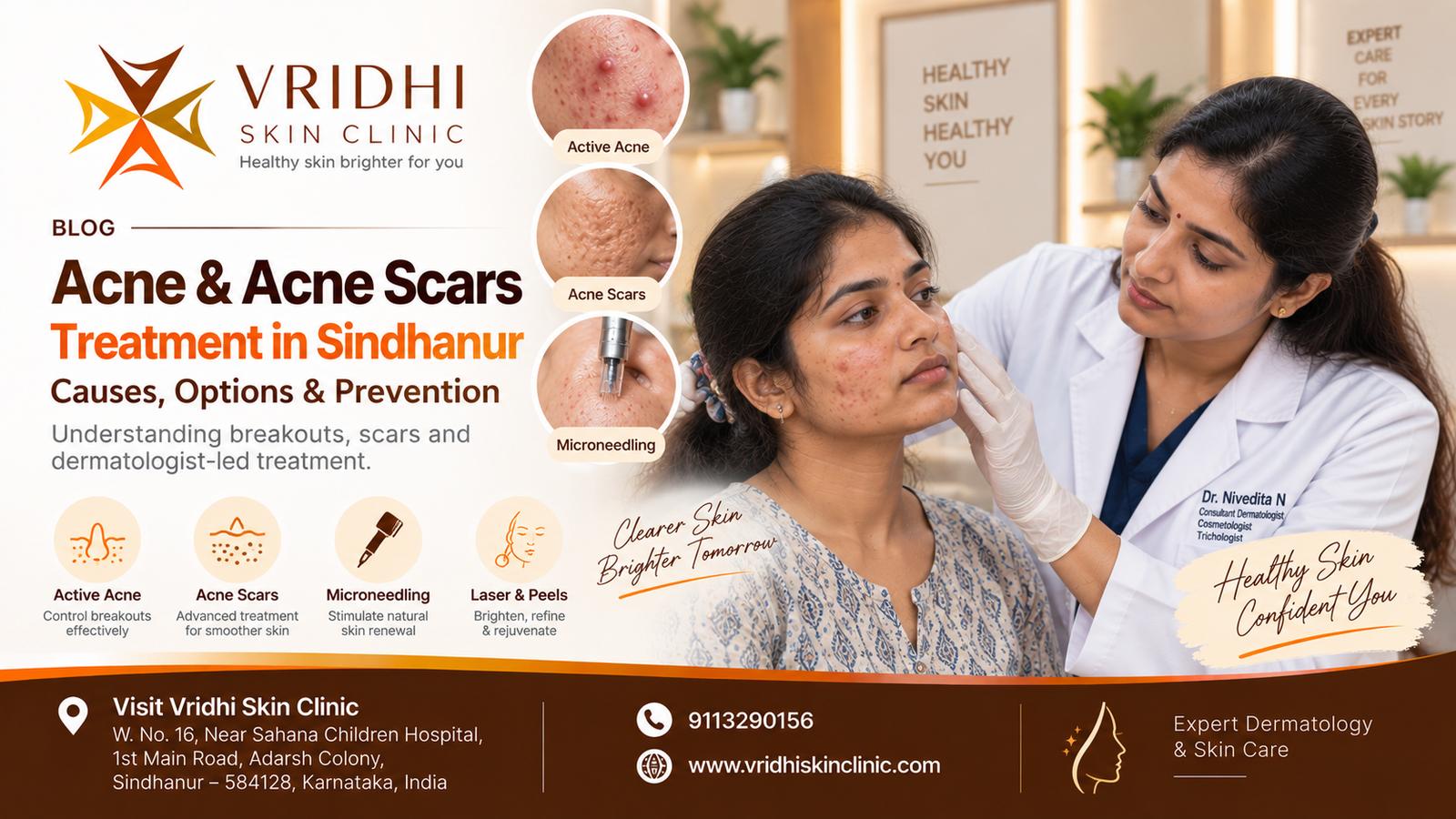 Acne and Acne Scars Treatment in Sindhanur: Causes, Options & Prevention