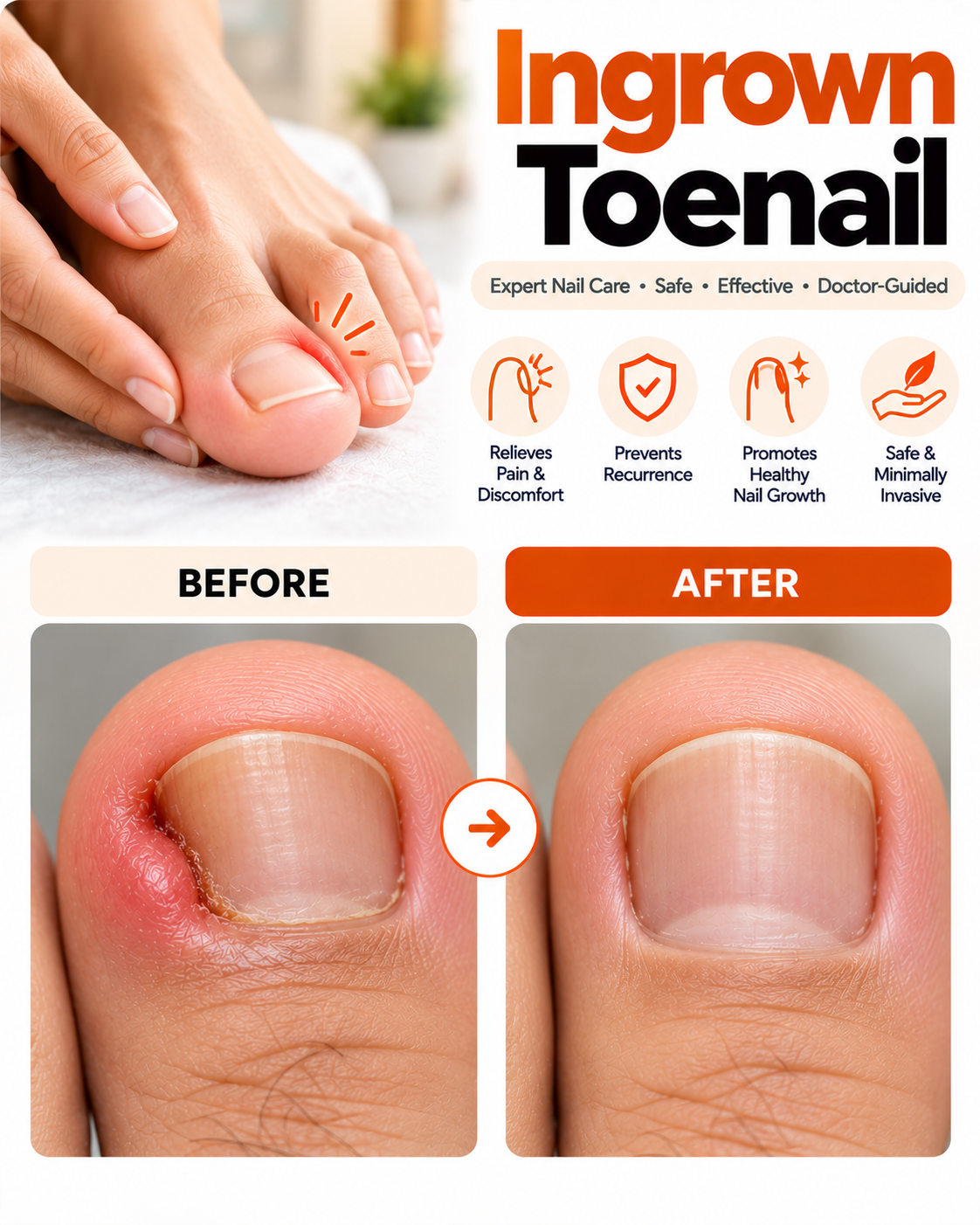 Ingrown toenail treatment before and after at Vridhi Skin Clinic, Sindhanur