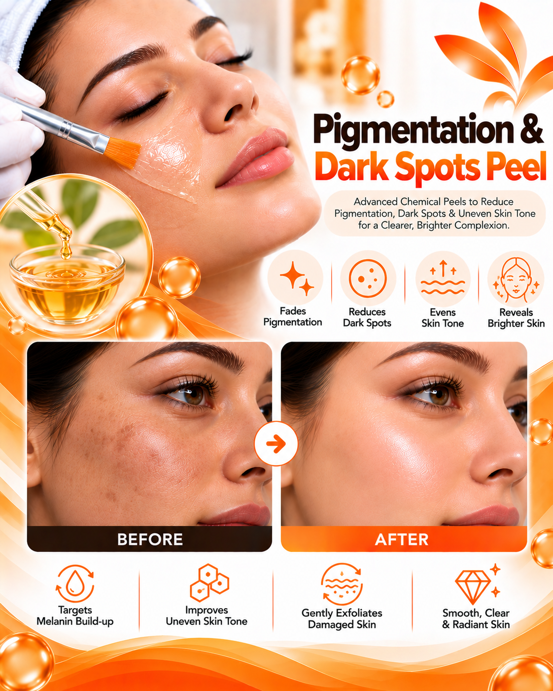 Chemical peel for pigmentation and dark spots before and after at Vridhi Skin Clinic, Sindhanur